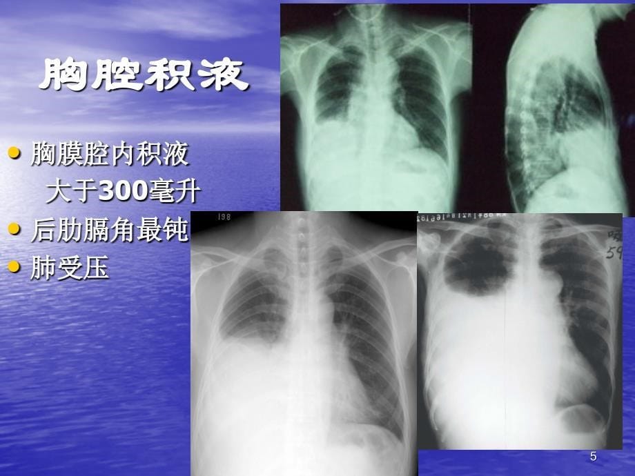 简化记忆X线、CT、B超-执业医师 技能考试幻灯片_第5页