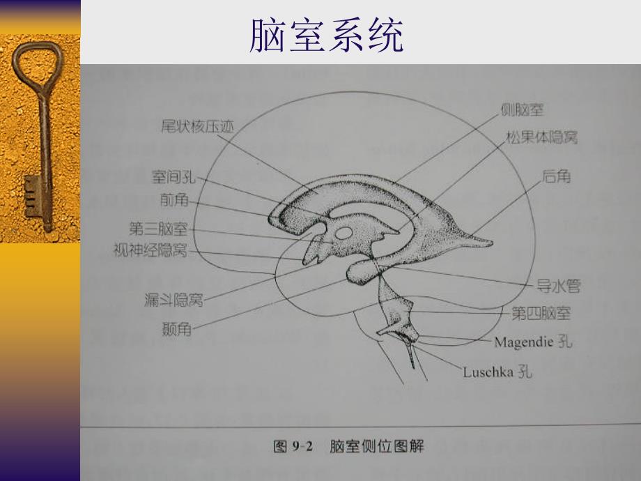 脑积水幻灯片1_第2页