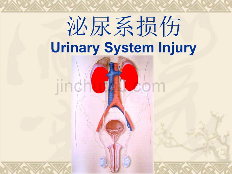 泌尿系损伤病人的护理73幻灯片_第4页