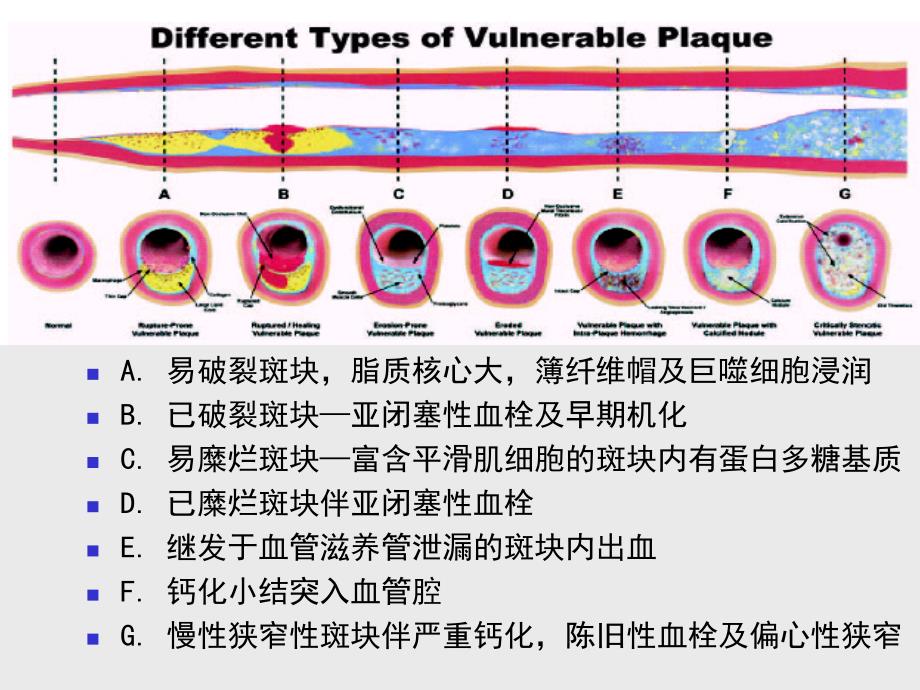 易损班块_第4页