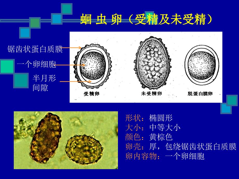 寄生虫实验幻灯片_第3页