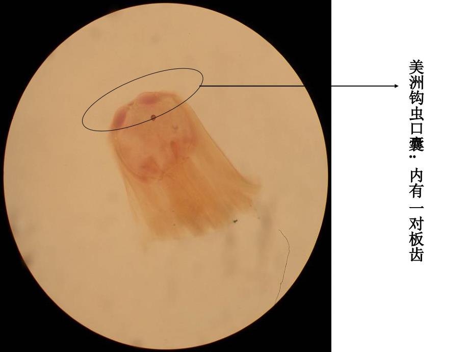 寄生虫实验考相关标本幻灯片_第4页