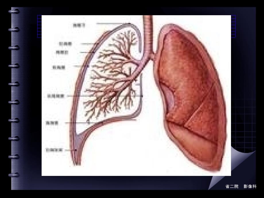 胸膜实性病变_第2页