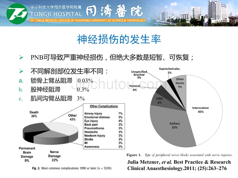 外周神经阻滞相关神经损伤医学课件_第4页