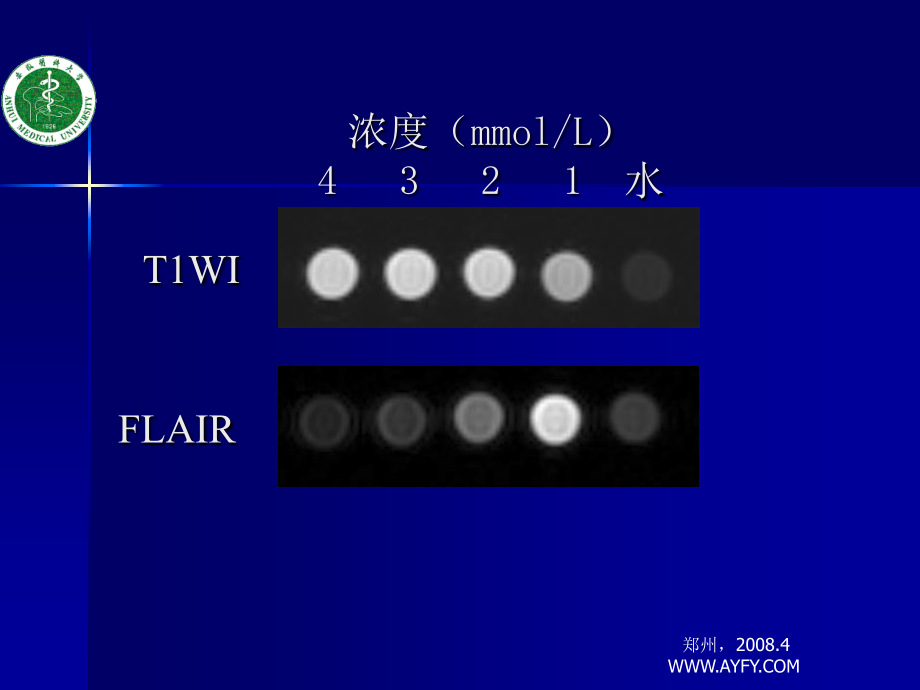 增强FLAIR在中枢神经系统的应用_第4页