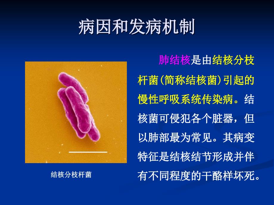 肺结核与药物治疗_第3页