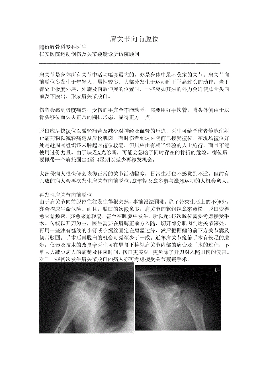 肩关节向前脱位 - 仁安医院_第1页