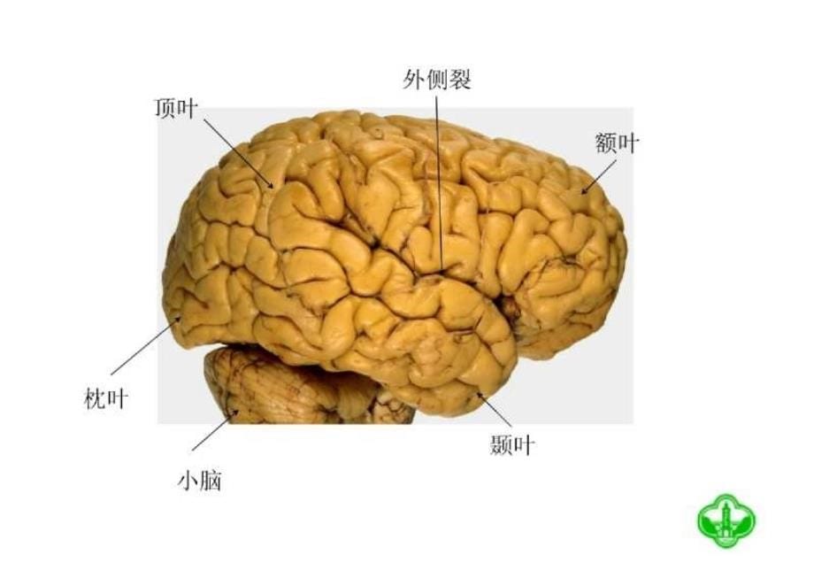 颅脑断面解剖_第5页