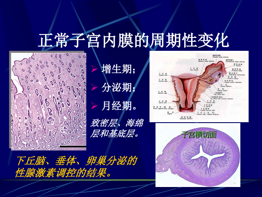 子宫内膜和乳腺疾病_第3页
