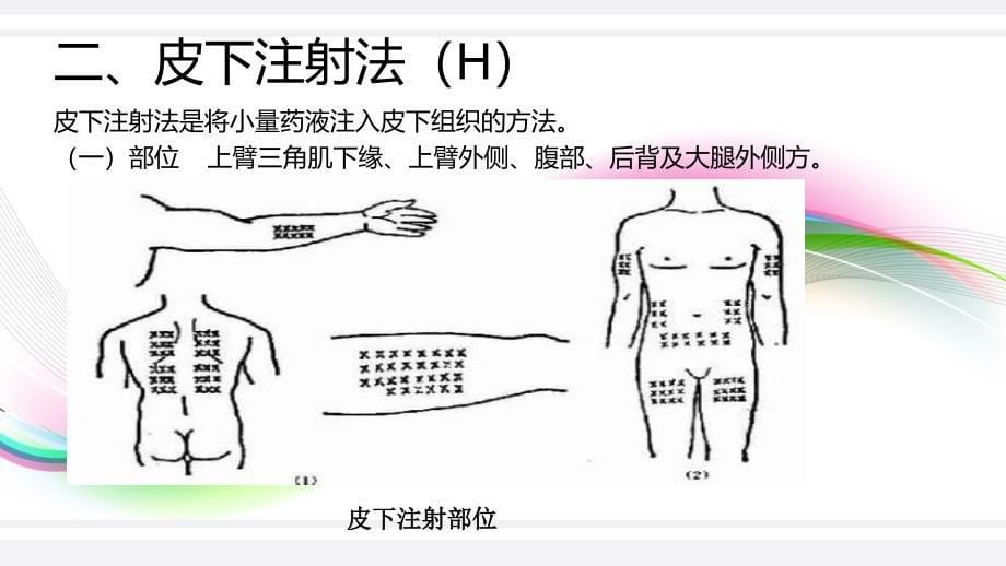 各种注射部位定位法_第5页