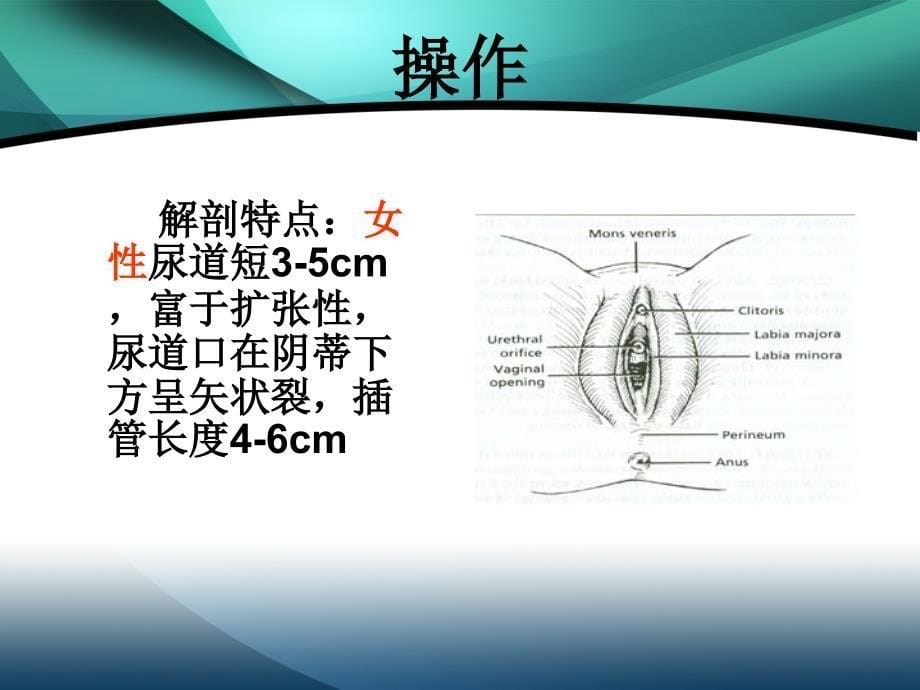 留置气囊导尿管存在的护理问题及处理_第5页