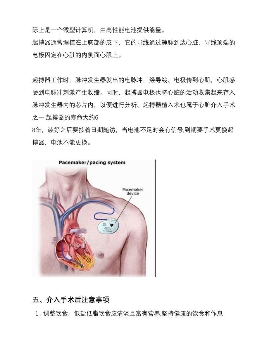 心脏介入简介_第5页