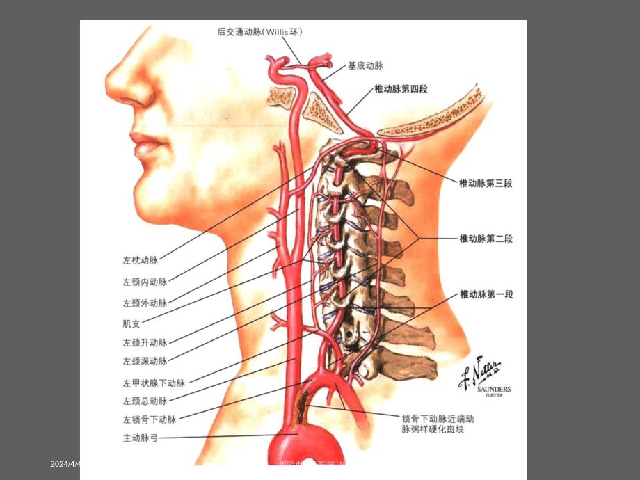 脑梗死的中西医诊疗及药物指导课件_第4页