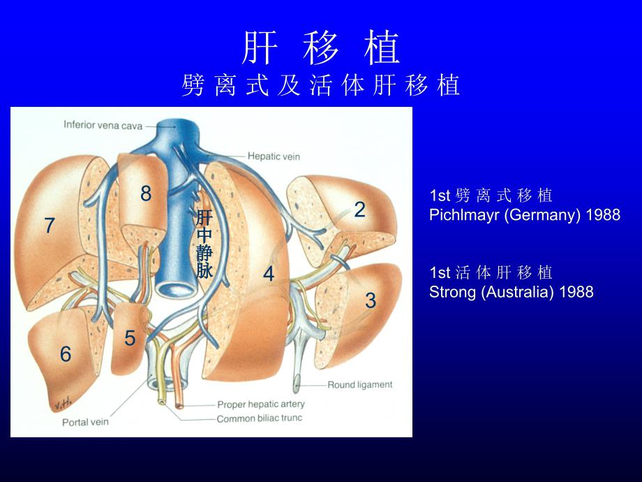 〖医学〗劈离式肝移植： 手术技术及供体的评估_第2页