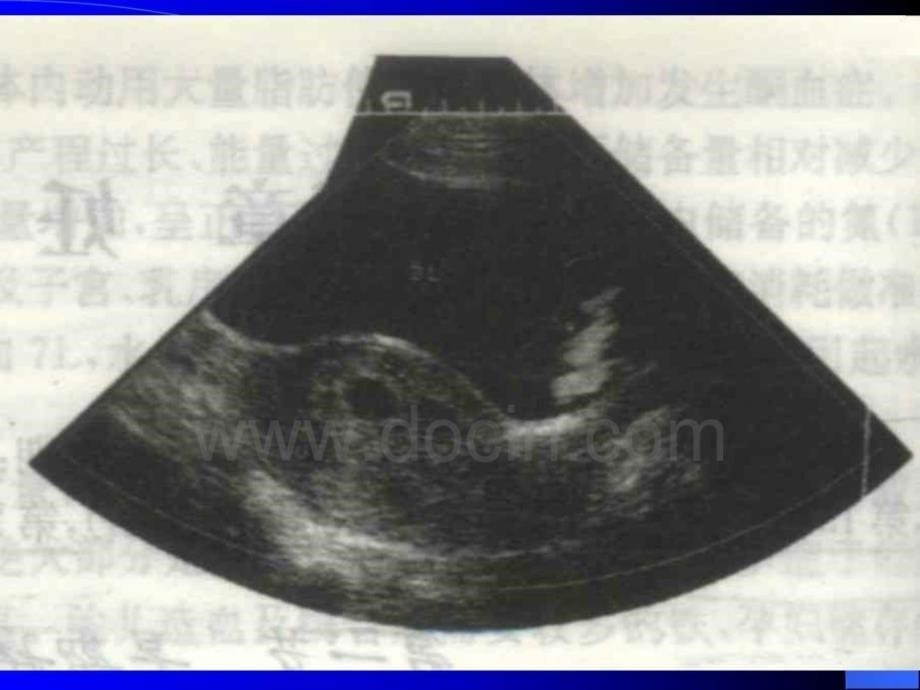 临床医学妇产科学_第5页