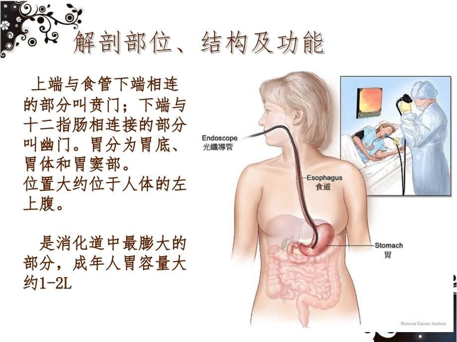 胃癌病人的护理 课件_第5页