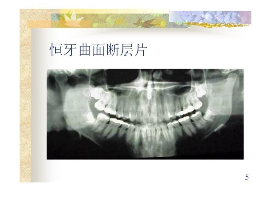 口腔外科学-儿童牙病[精品]_第5页