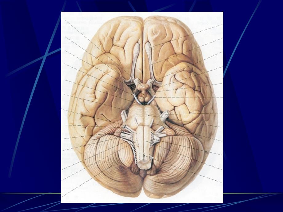 头部连续横断层解剖及CT、MRI_第4页