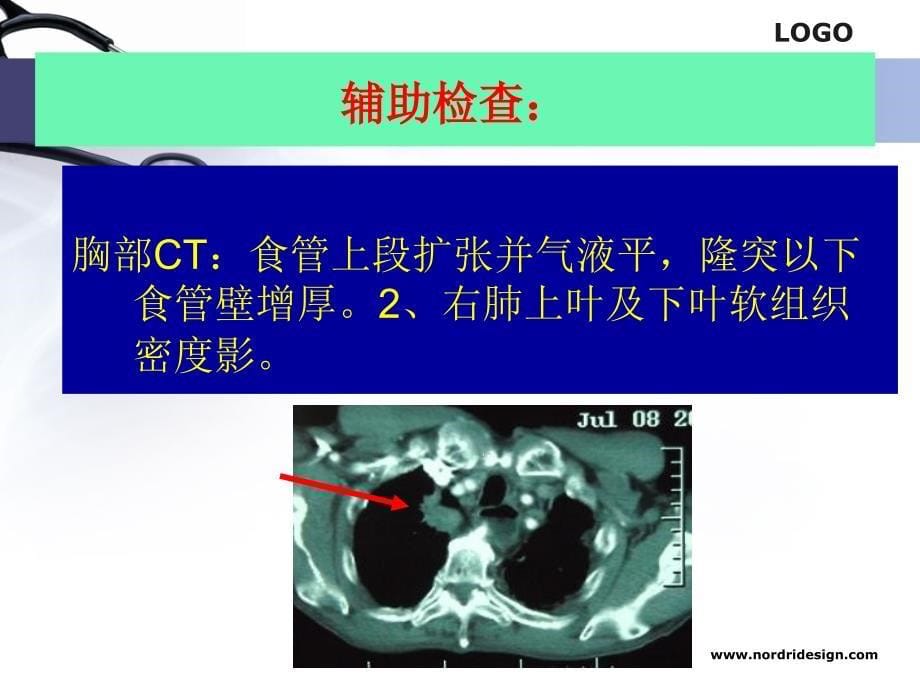 病例讨论修改_第5页