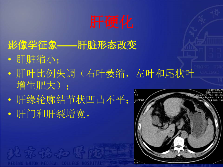 腹部实质脏器疾病影像学表现_第4页