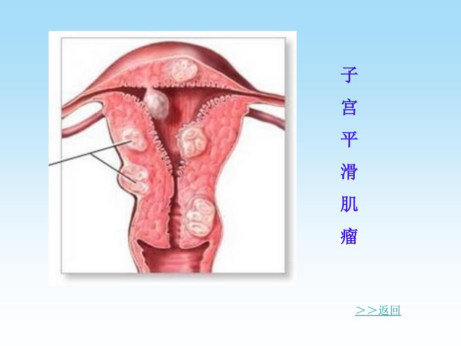 肿瘤的生长和扩散_第4页