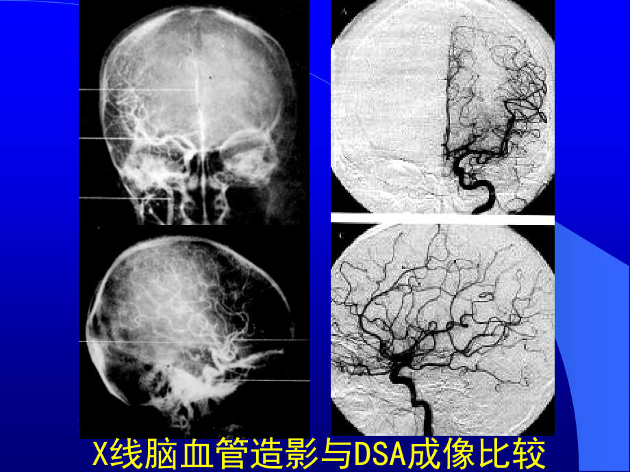 脑血管应解剖_第4页