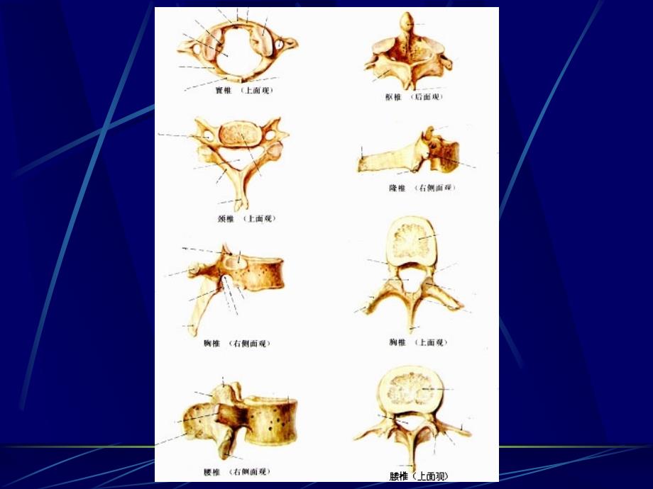 脊柱区断层解剖及CT、MRI_第4页