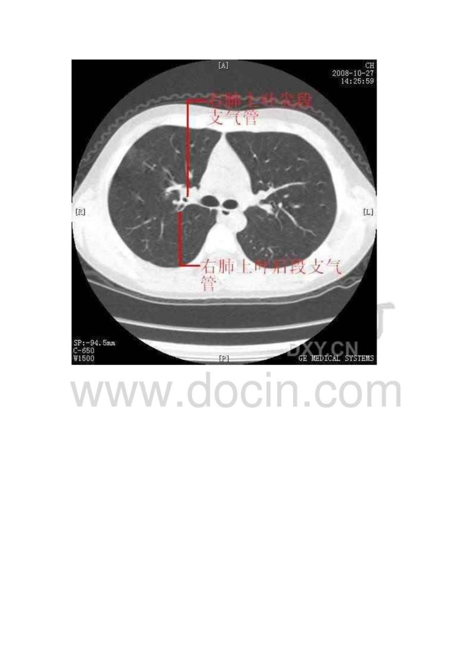 绝对值得珍藏的经典CT图解_第3页