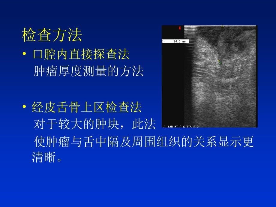 舌癌及其周围淋巴结的超声诊断_第5页