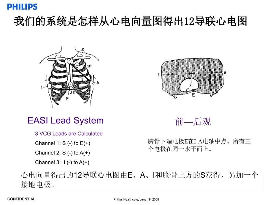 holter动态心电介绍课件_第5页