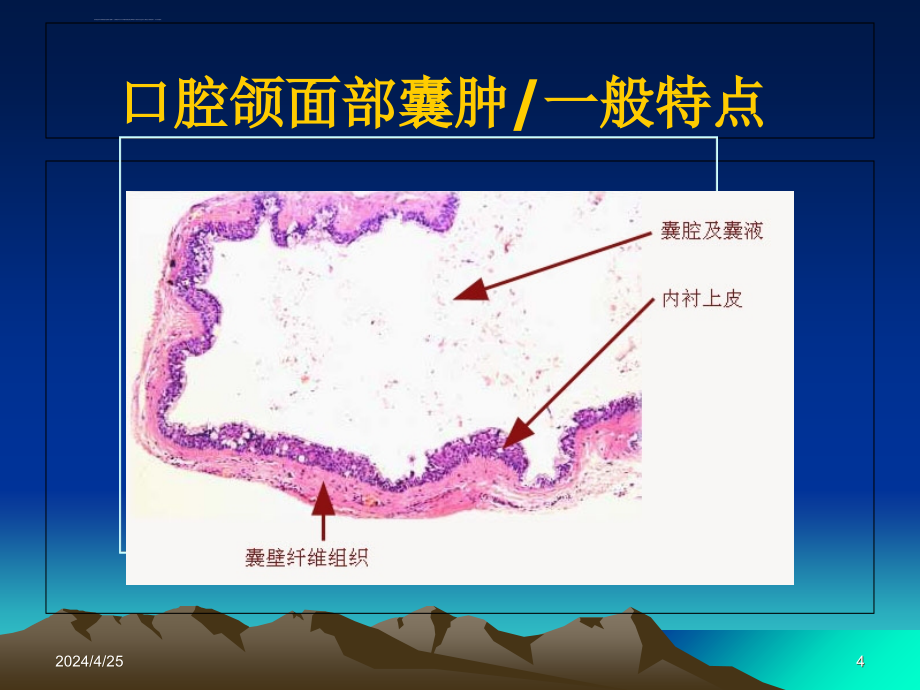 第十七 章口腔颌面部囊肿课件_第4页