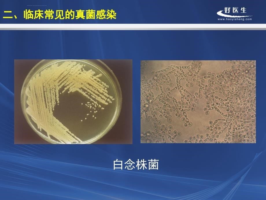 icu真菌感染的诊断与防治(长征医院)课件_第5页