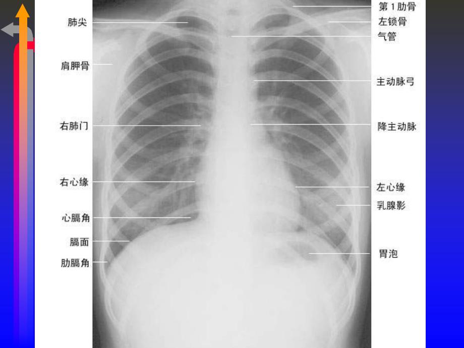 检查定位线_第2页