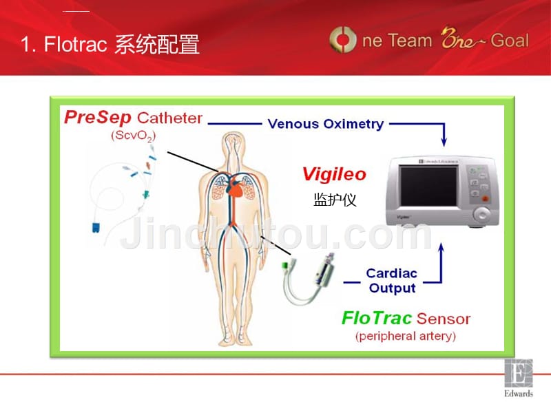 flotrac运用apco指导围术期容量管理_第3页