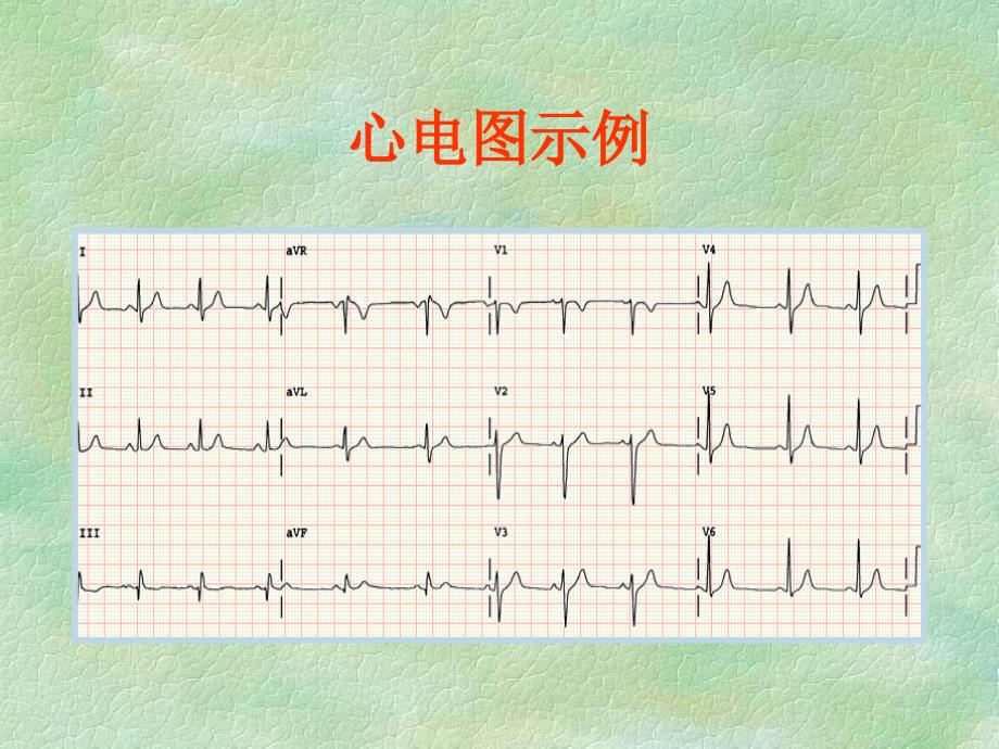 心电图基础执业医师讲课_第3页