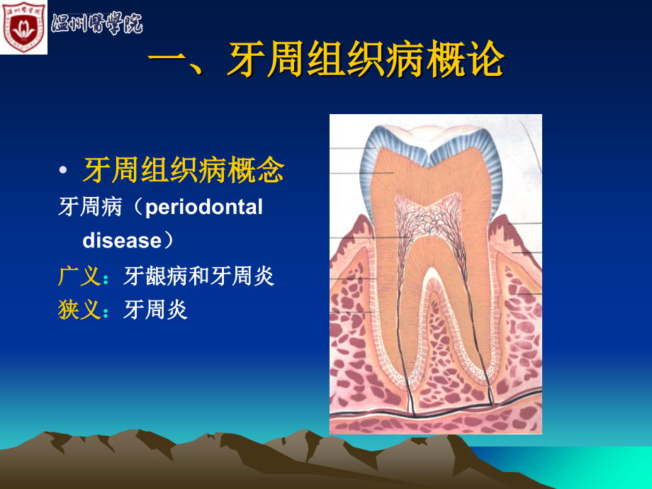 第十一章 牙周组织病课件_第4页