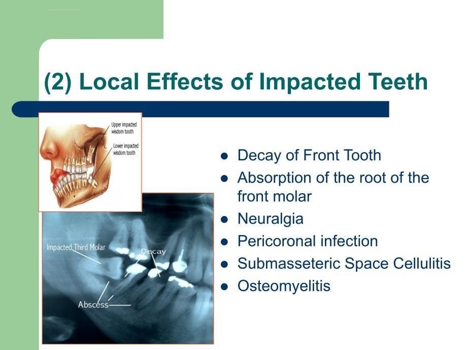 chapter 7 extraction of teeth分析课件_第5页