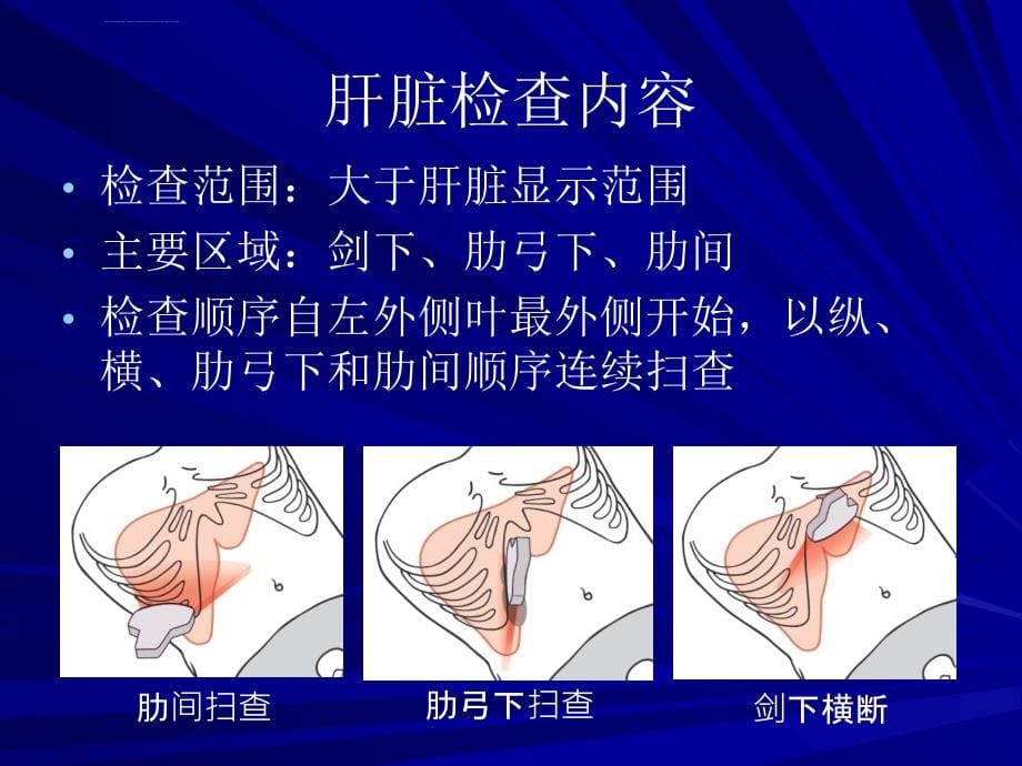 肝脏超声检查（肝脏）课件_第5页