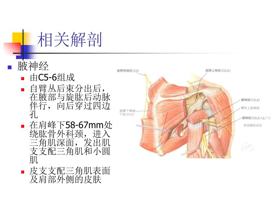 肩四边孔综合症课件_第2页