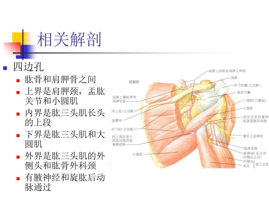 肩四边孔综合症课件_第3页