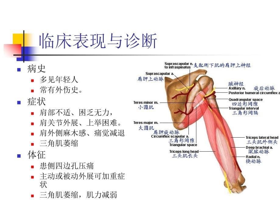 肩四边孔综合症课件_第5页