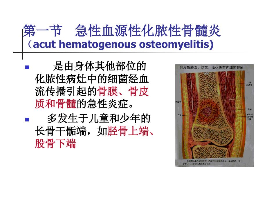 骨与关节感染病人的护理课件_第4页