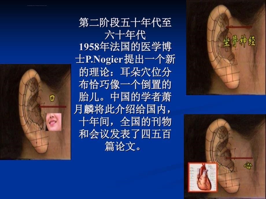 耳针分析_第5页