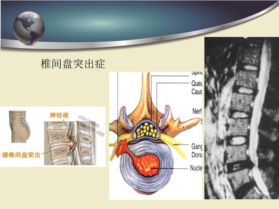 一次性纤维环缝合器PPT课件_第3页