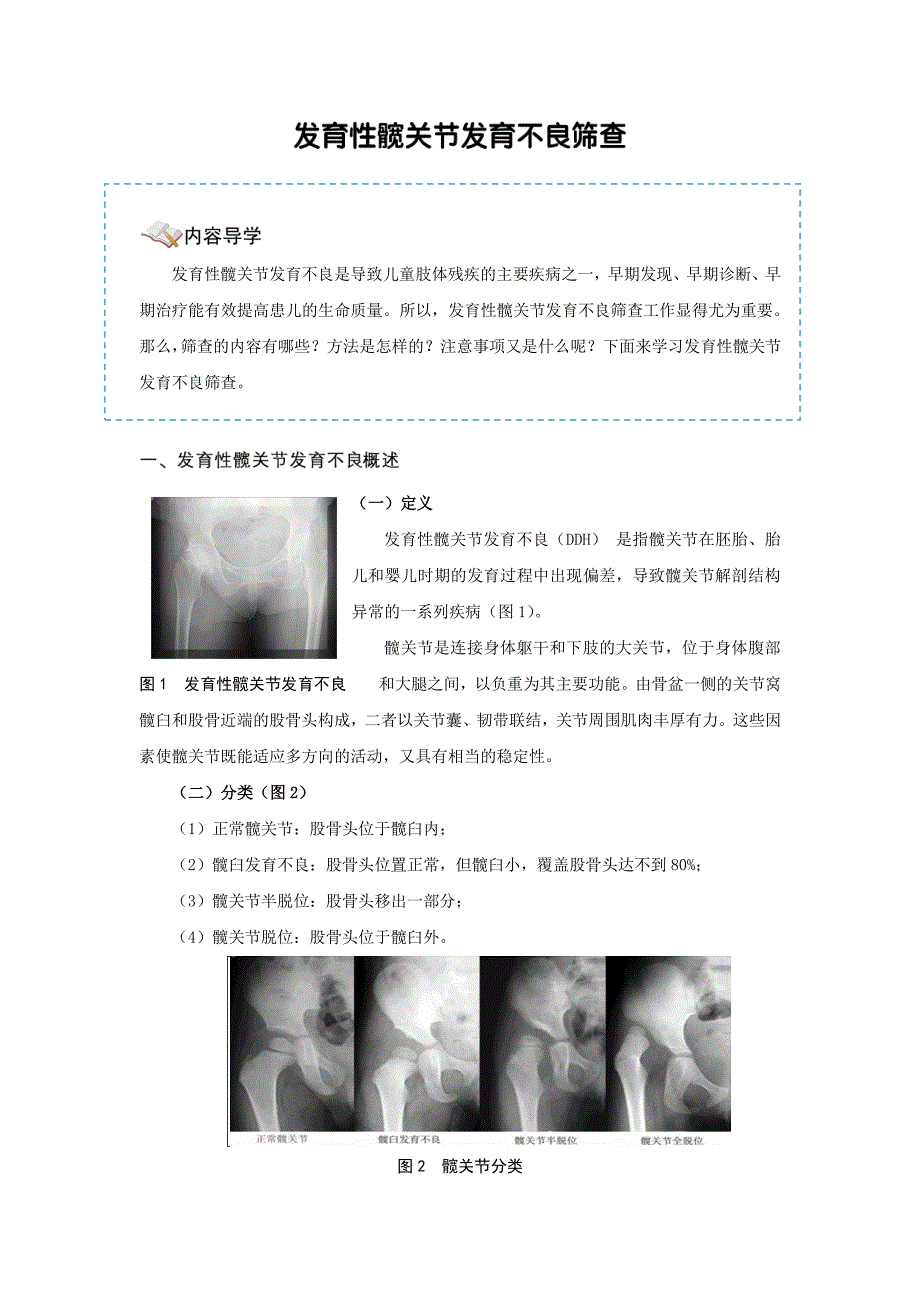 发育性髋关节发育不良筛查-讲义_第1页