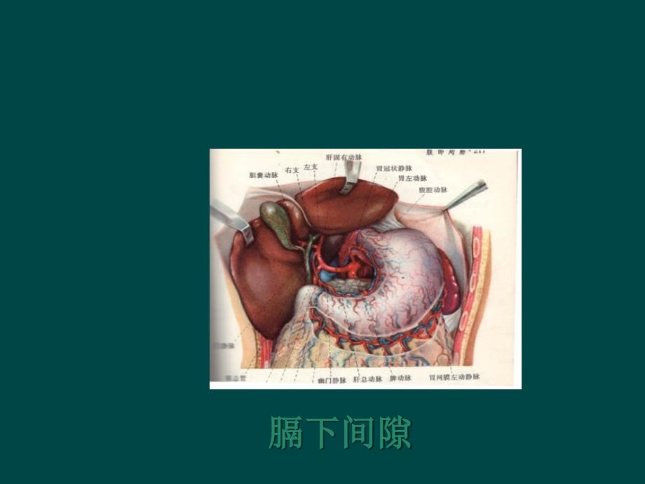 腹腔脓肿的诊断及治疗医学PPT_第2页