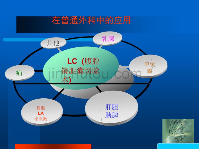 腹腔镜技术在腹部相关疾病中的应用PPT课件_第4页