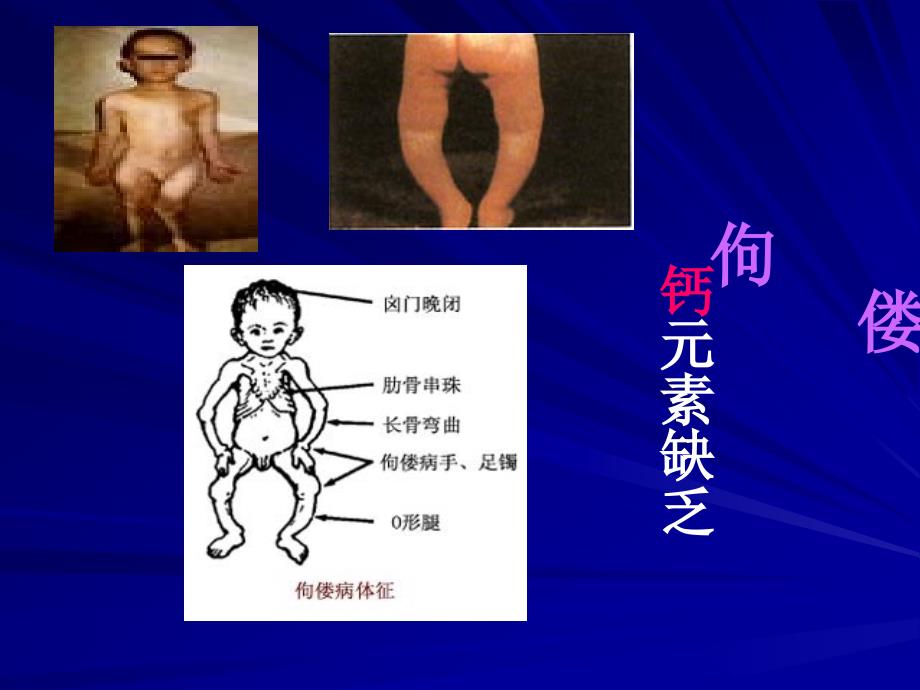 化学与人体健康最新课件_第4页