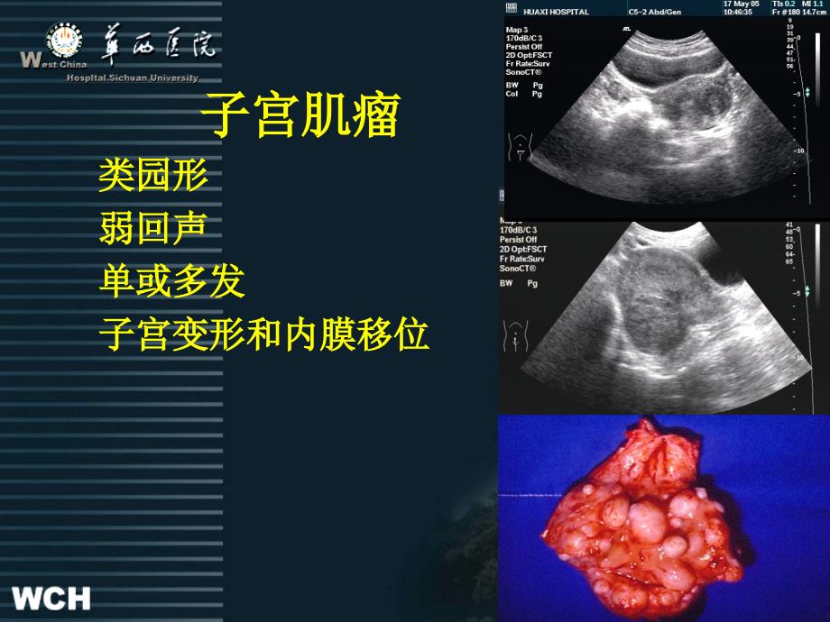 妇产科及心脏超声2新_第4页