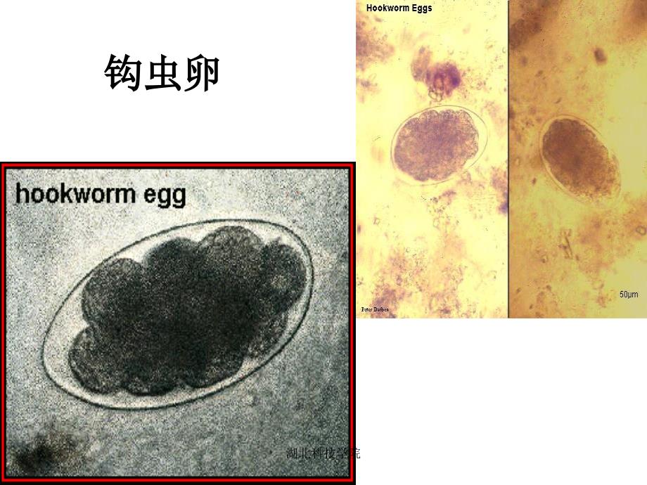 寄生虫标本片(全)1_第3页